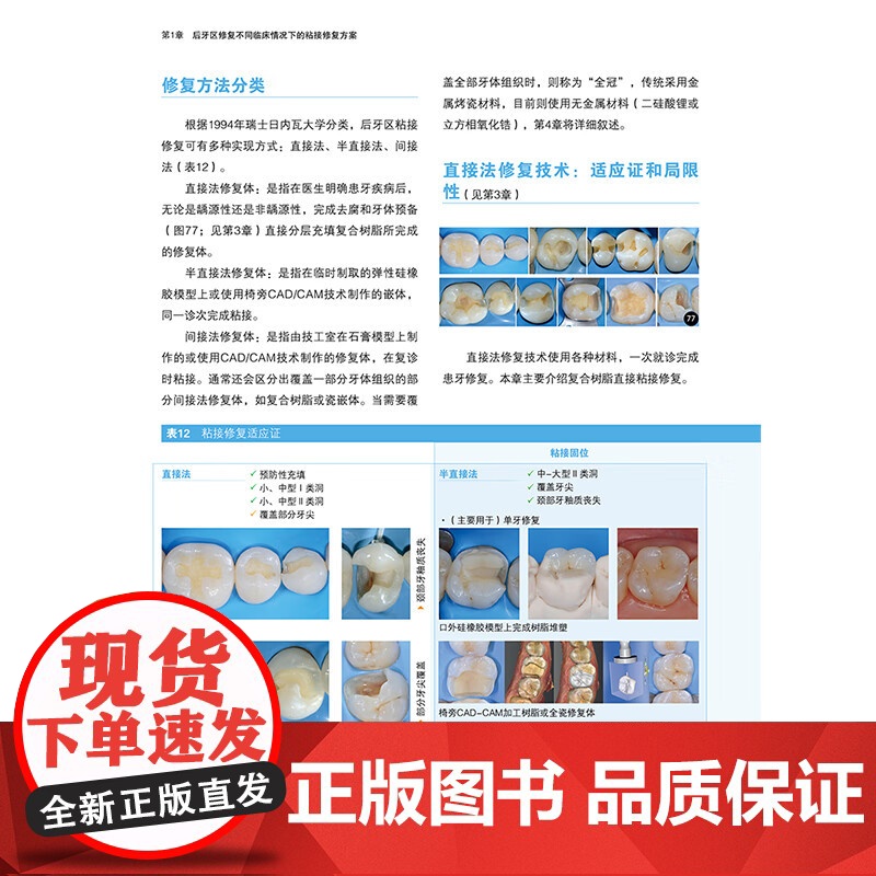 [出版社]全2册微创修复解决方案2本套装非龋性牙体硬组织疾病 牙体修复概论 传统粘接固位修复体 刘擎 辽宁科学技术出版社高清大图