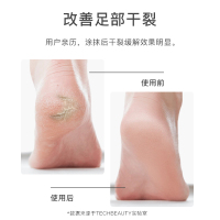 科靓Techbeauty人参籽油护足霜 滋润防冻干裂手足霜皮裂膏手脚后跟干裂防裂膏手足脚底开裂 足部护理用品
