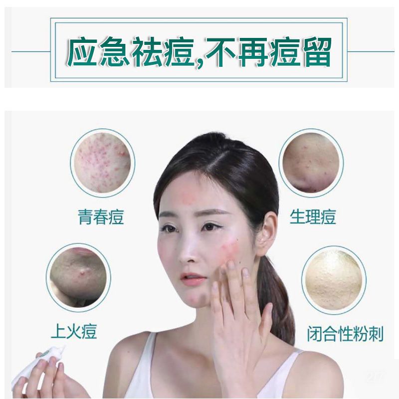 曼秀雷敦乐肤洁抗痘护理啫喱淡化痘印青春痘学生凝胶 抗痘啫喱18g