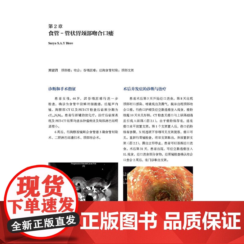 消化道术后并发症实例分析 本书为每种并发症都配有2到3个病例 所有病例均来自作者的临床手术实践 是第一手的珍贵资料高清大图