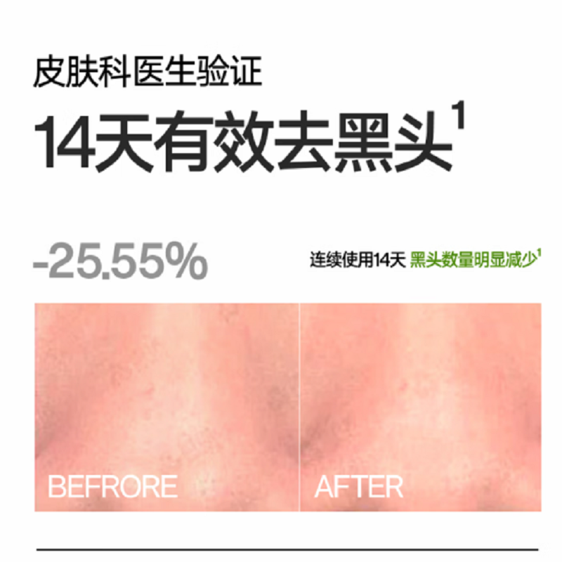 理然有效控油2件套装(有效控油洁面乳150g+水凝露100g)高清大图