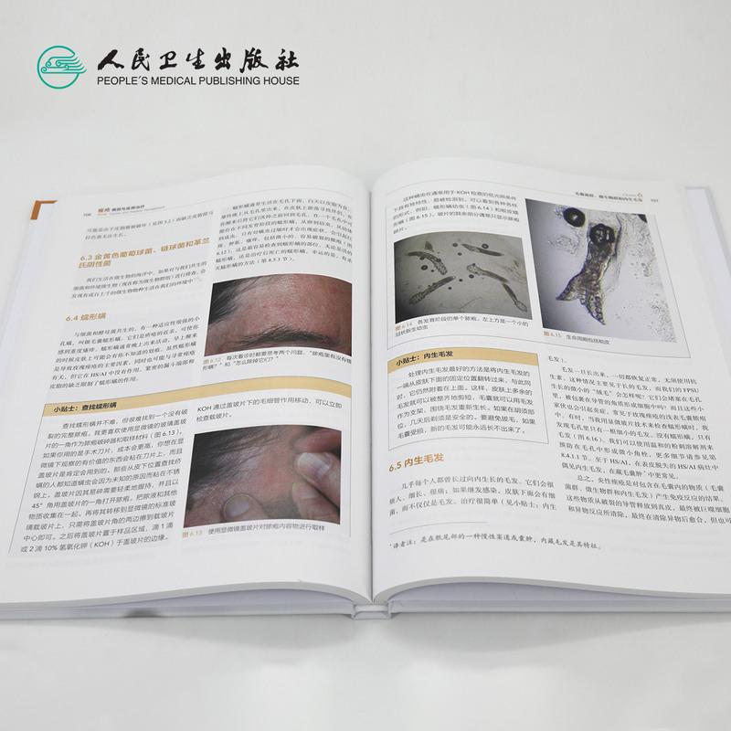 [友一个正版]病因与实用治疗 丛林尹志强冰寒痘痘中国临床皮肤病外科学医学光子人民卫生出版社美容皮肤科学专业知识高清大图