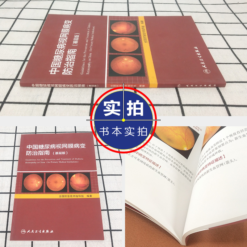 [正版] 中国糖尿病视网膜病变防治指南-基层版 全国防盲技术指导组编著 眼科学疾病临床案例诊治教程 人民卫生出版社978高清大图