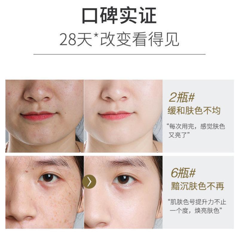 377vc美白断黑精华液三七七维c祛黄淡斑去黑色素提亮肤色原液套盒 [源头断黑]VC原液30ml*1瓶