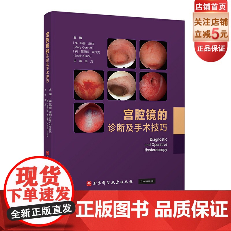 宫腔镜的诊断及手术技巧 子宫疾病 内窥镜检 妇科外科手术 北京科学技术高清大图