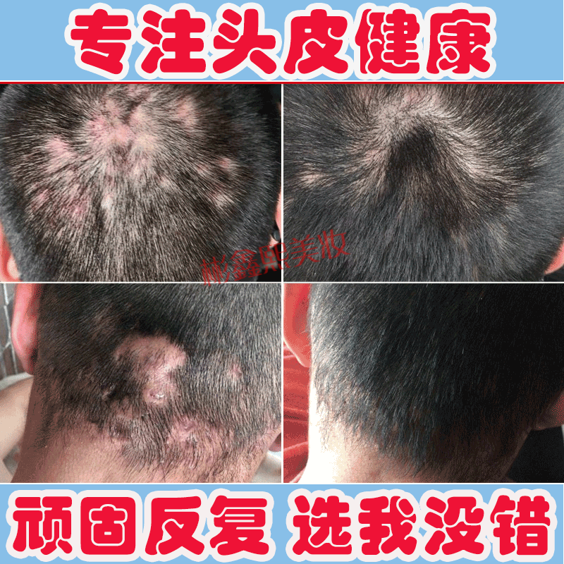 樱萃洗发水报价_参数_图片_视频_怎么样_问答-苏宁易购