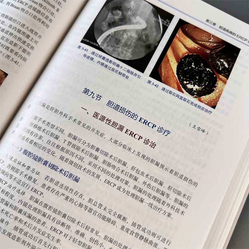 [正版]胆胰疾病ERCP诊断与治疗 周文策,李汛 编 内科学疾病诊治资料图书 医学类书籍 科学出版高清大图