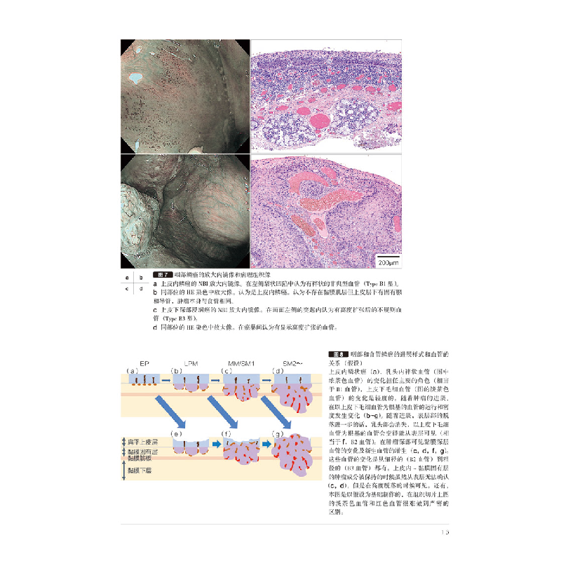 正版新书]咽部和食管内镜放大观察的基础与最新发现日本《胃与肠高清大图