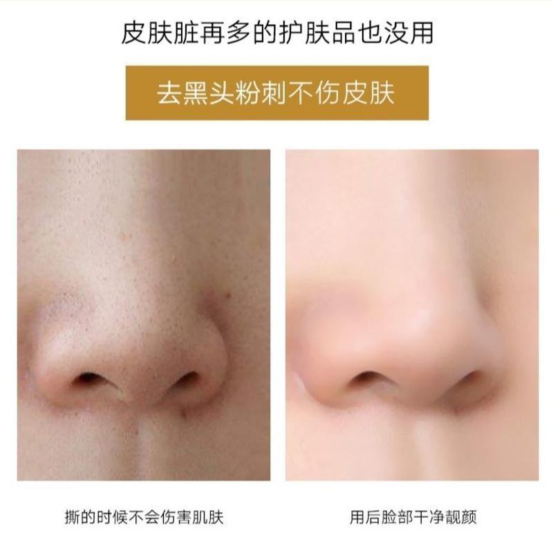 美白祛斑去黄撕拉面膜痘印收缩毛孔去黑头粉刺角质补水控油祛痘印 撕拉面膜(一支装)