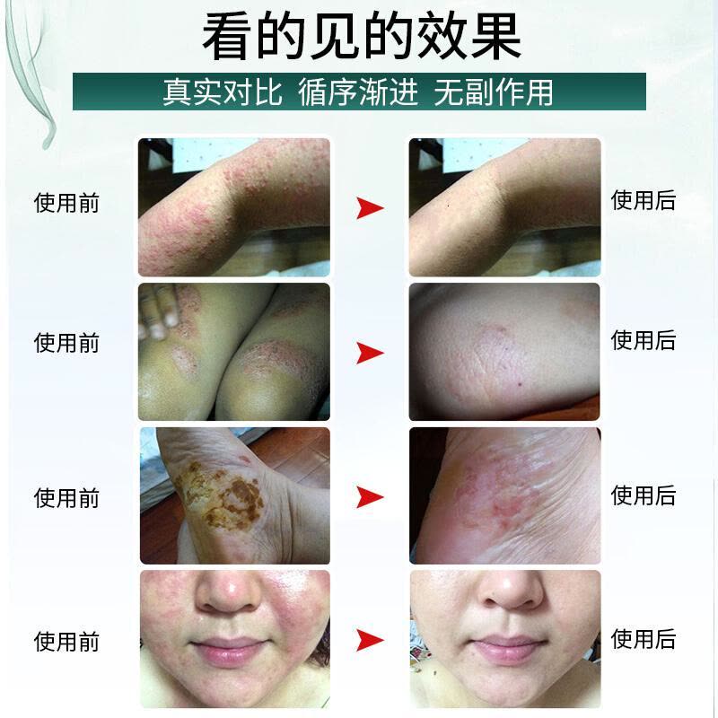 乐仁御方御洛百灵 买2送1再减10元快速图片