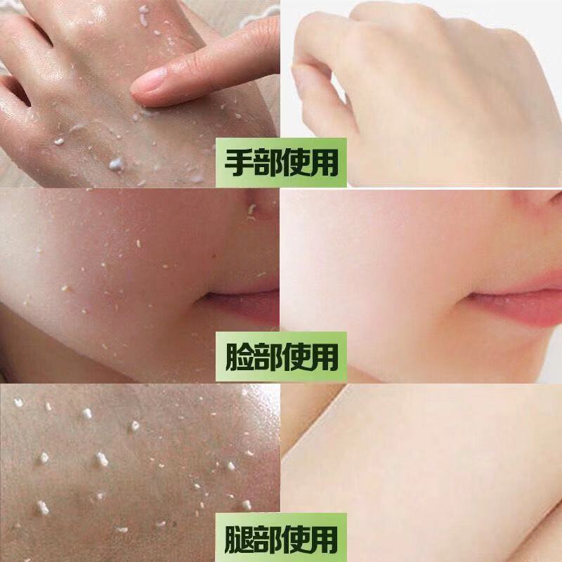 []芦荟去角质皮去黑头磨砂膏洗面奶脸部美白大瓶女 [特价无送]芦荟去角质1支