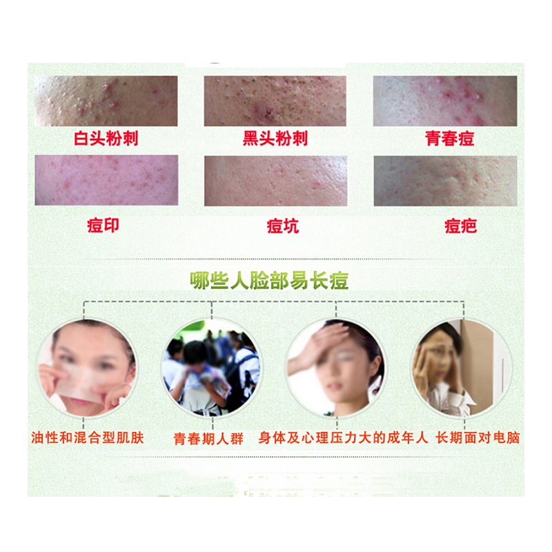 同仁堂祛痘膏套装男女祛痘产品(祛痘洁面100g+祛痘精华30g+祛痘膏30g)草本配方控油补水