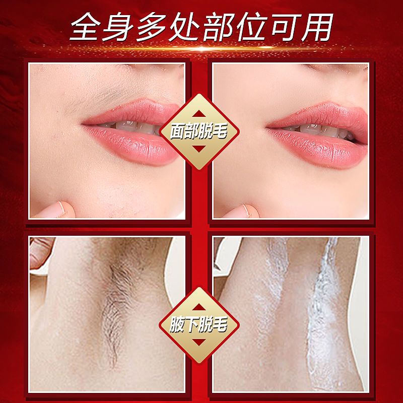 脱毛膏女面部去小胡子脱唇毛全身学生党腋下根半永久男脱毛仪神器 进口配方3件套/1套