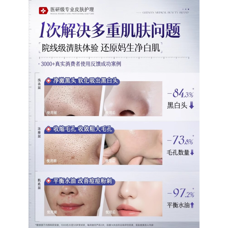 RUYI儒意净透控油去黑头泥膜130g高清大图