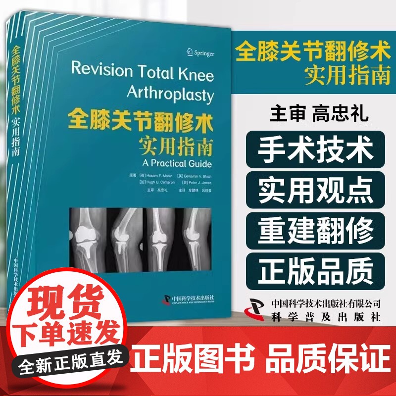 DF【央视网】全膝关节翻修术:实用指南复杂初次全膝关节置换术 全膝关节翻修术的适应证 旋转饺链假体整形手术 中国科学技术