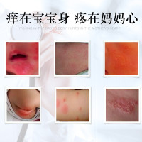 紫草膏宝宝湿疹膏戒馆之婴亲霜 婴儿口水疹尿布疹热痱子湿疹皮炎红屁屁护臀膏 奶廯润肤面霜淹红脖子肤乐霜皮肤止痒膏消肿膏面霜