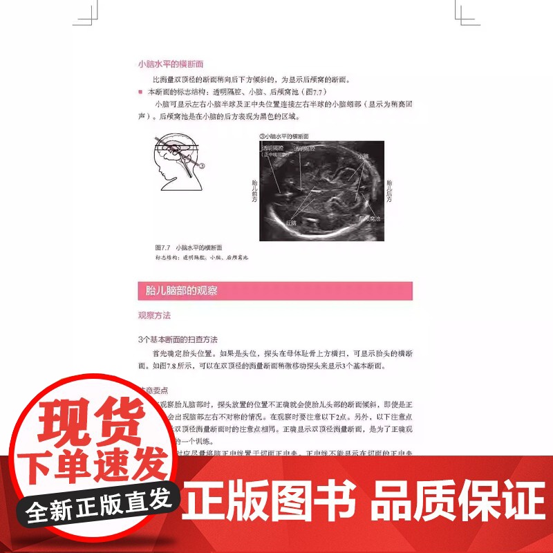 胎儿超声扫查技巧图解 胎儿 超声 扫查技巧图解 覆盖ISUOG孕期筛查全路径实用指导书 胎儿超声波检查 正版书籍高清大图