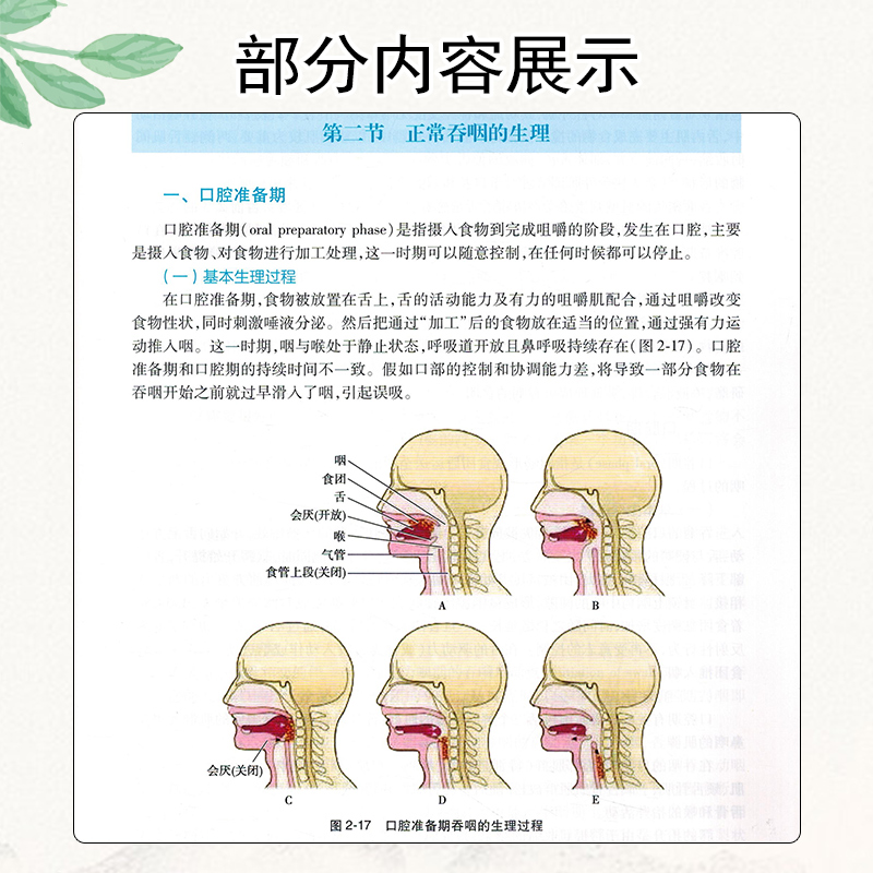 [正版] 康复治疗师临床工作指南 吞咽障碍康复治疗技术 主编万桂芳 张庆苏 康复医学临床案例诊治教程 人民卫生出版社97高清大图