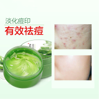朵拉朵尚dora dosun芦荟胶250g去痘印滋润补水保湿晒后修复清爽保湿补水面霜男女面膜面贴膜250ml