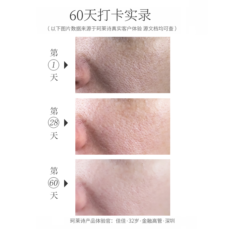 珂莱诗CRECHEZ细致毛孔美容液60g视黄醇精华A醇收缩粗大毛孔修复精华液淡纹紧致