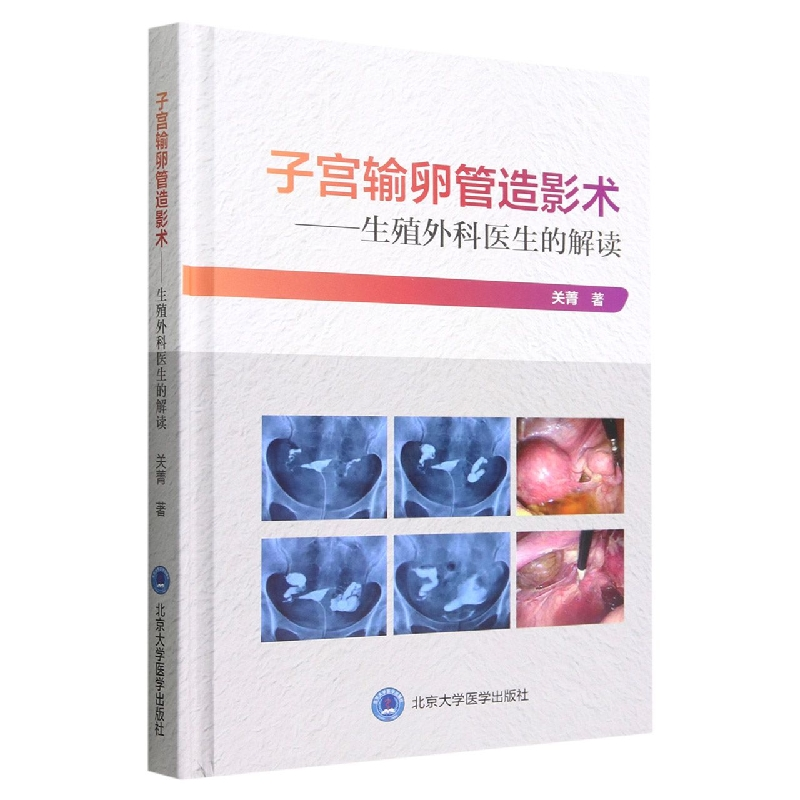 音像子宫输卵管造影术--生殖外科医生的解读(精)关菁