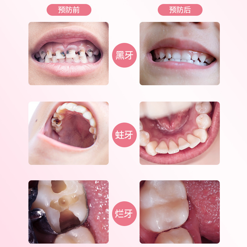 雪贝卡(xuebeika)牙膏报价_参数_图片_视频_怎么样_问答-苏宁易购