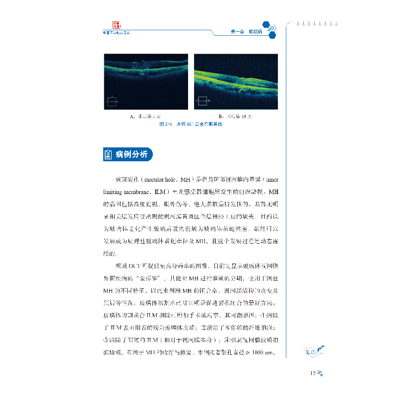 醉染图书南昌大学第二附属医院眼科病例精解9787518965403高清大图
