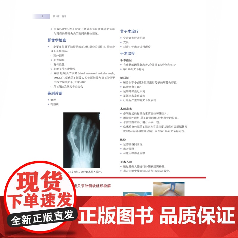 WIESEL骨科手术学·足踝外科 骨科手术技术精髓佳作手把手教学上海科学技术出版社高清大图