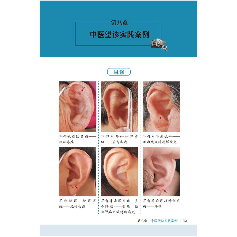醉染图书图解耳诊面诊眼诊手诊9787117331616图片