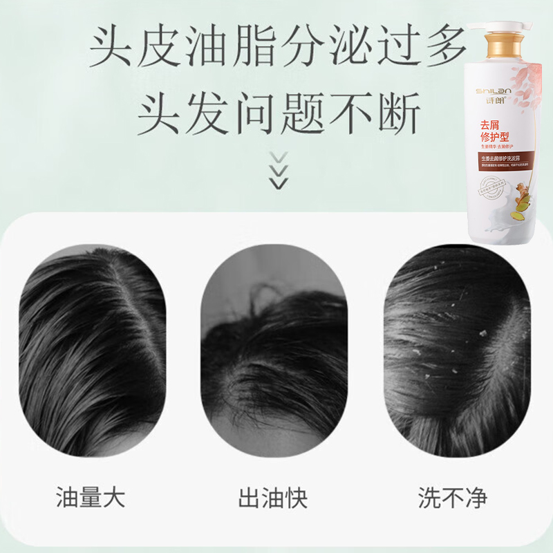 诗朗洗发露500g养润控油柔顺头皮舒缓生姜去屑修护SL03高清大图