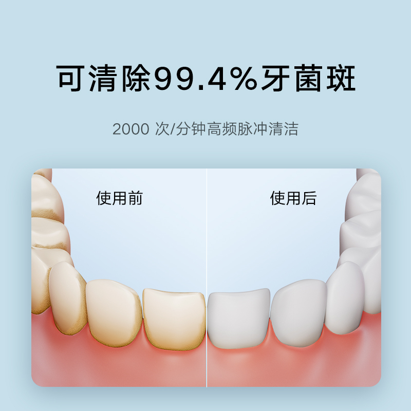 小米(MI)电动冲牙器 F300 米家原装便携式家用水牙线口腔洁牙立式洗牙器官方正品旗舰店
