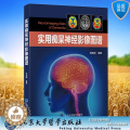 【醉染正版】 正版 实用痴呆神经影像图谱 郑东明 编著 北京大学医学出版社 9787565926医东6