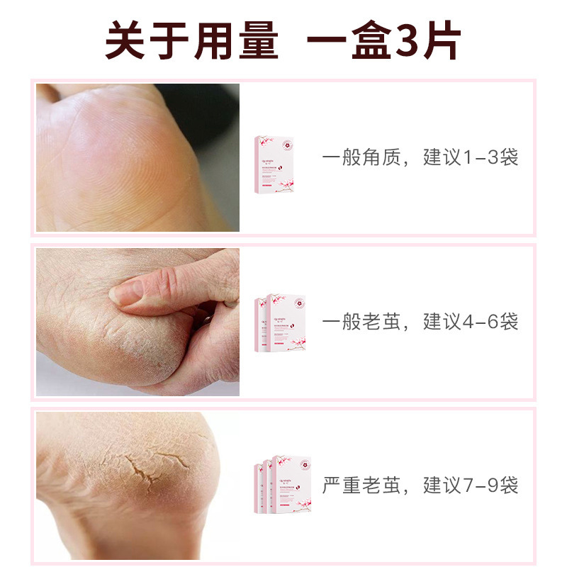 泉兮桃花脱皮柔嫩足膜 脱皮去角质足膜厂家直销盒装