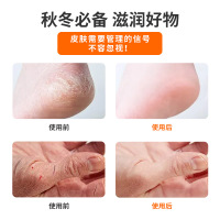 金泰康马油膏手脚后跟防干裂修复霜皲裂膏护手霜防干裂 金泰康马油膏[拍1发5]80g*5盒