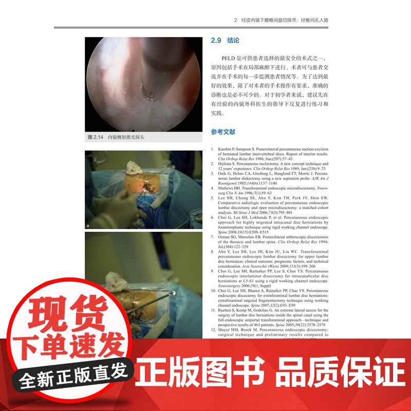 脊柱内镜手术技术 视频配合学习 外科手术图解 临床应用 手术技巧分析 病例分析 北京科学技术高清大图