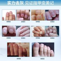 [苏宁专营店]4支装灰指甲专用液一笔亮生物修护膜去除增厚官灰甲净药水