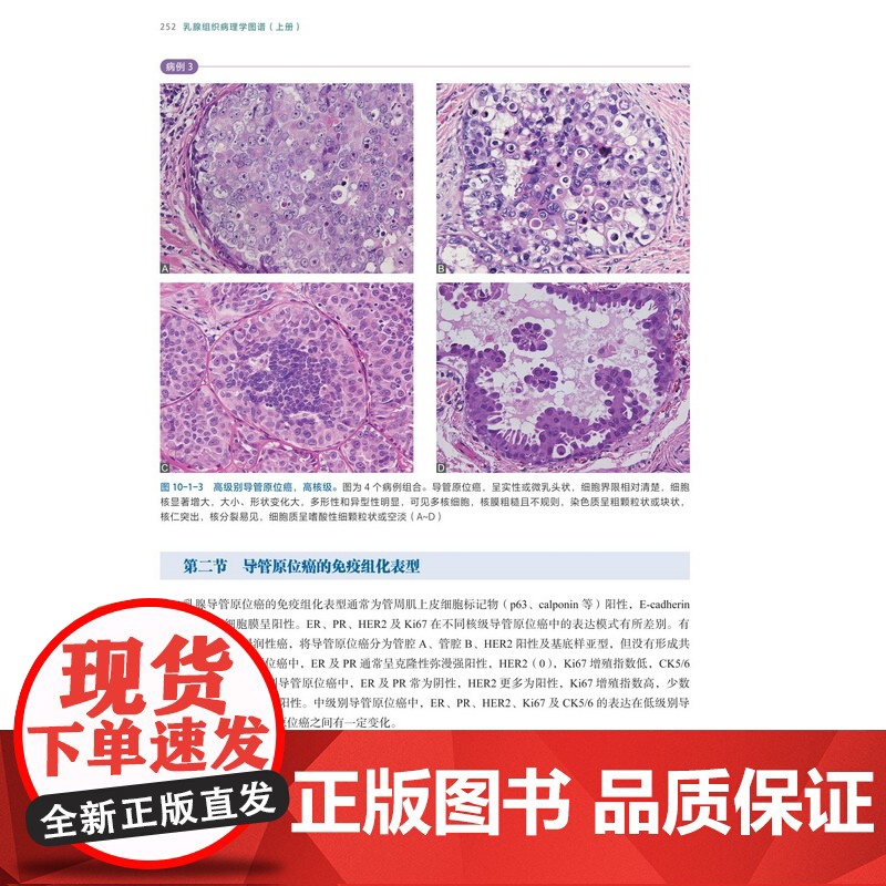 乳腺组织病理学图谱 上下册 乳腺组织学 乳腺疾病 病例讨论 高清图解 北京科学技术高清大图