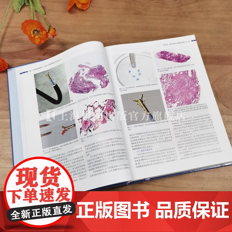 实用肺部病理学 :基于6种病理模式的诊断方法 上海科学技术出版社高清大图