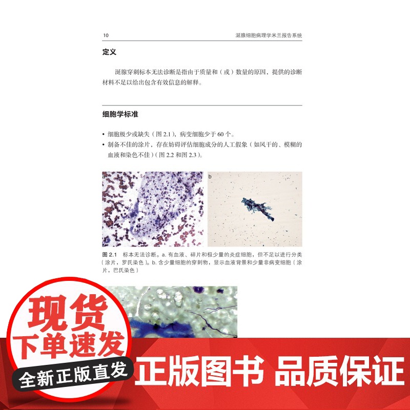 涎腺细胞病理学米兰报告系统 北京科学技术高清大图