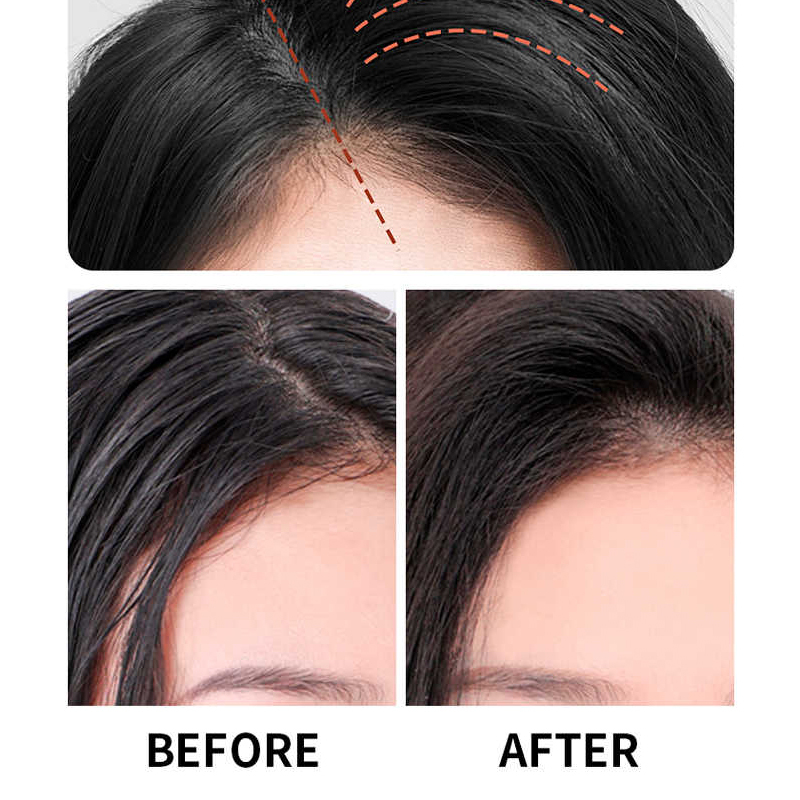 巴黎欧莱雅玻尿酸水光洗发露100ml*2清洁舒缓控油保湿护发去角质洗发露高清大图