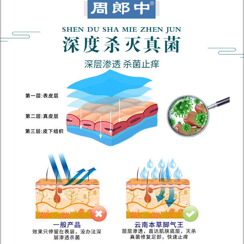 脚气止痒脱皮杀菌烂脚丫喷雾剂专用手足癣脚痒小水泡海泉茫外相对
