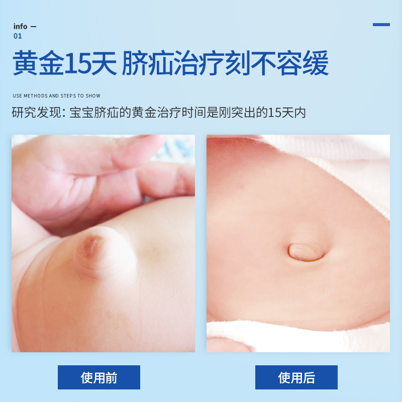 爱护佳婴儿脐疝带医用疝气带婴幼儿新生儿宝宝凸肚脐贴袋压疝包