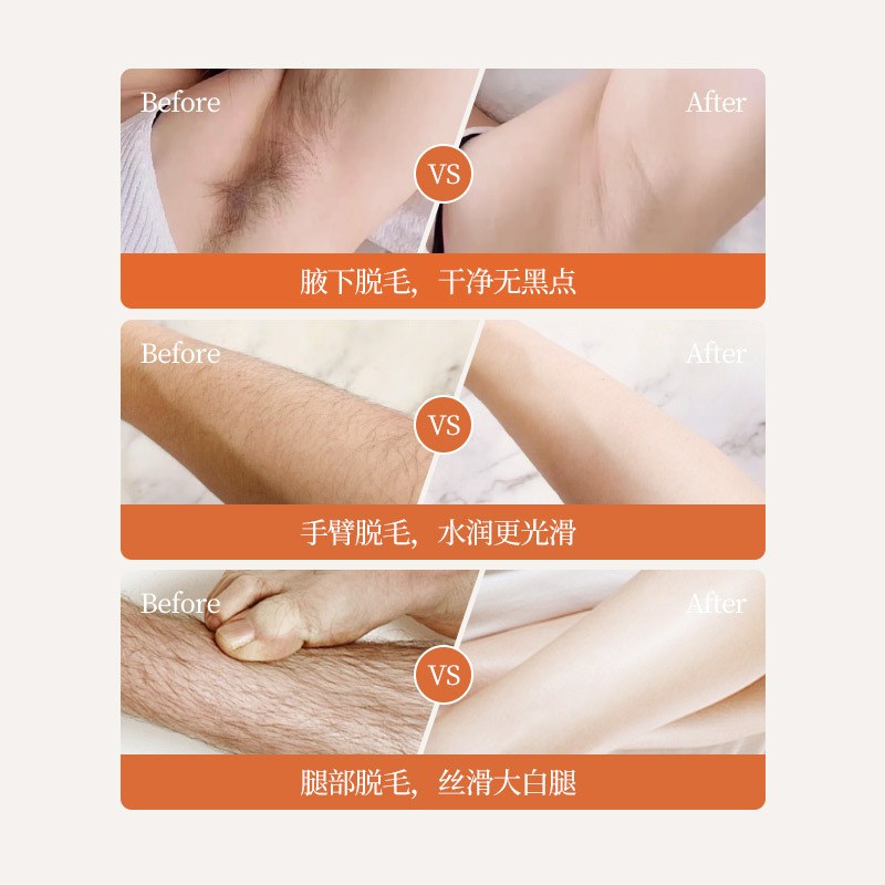 拜迪生物脱毛膏私密处去脱毛男女士专用脱腋下腿毛密去阴全身比基尼