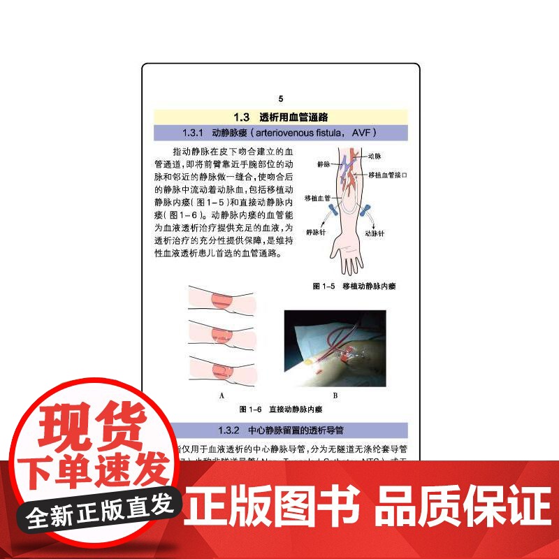 儿童血管通路管理高清大图