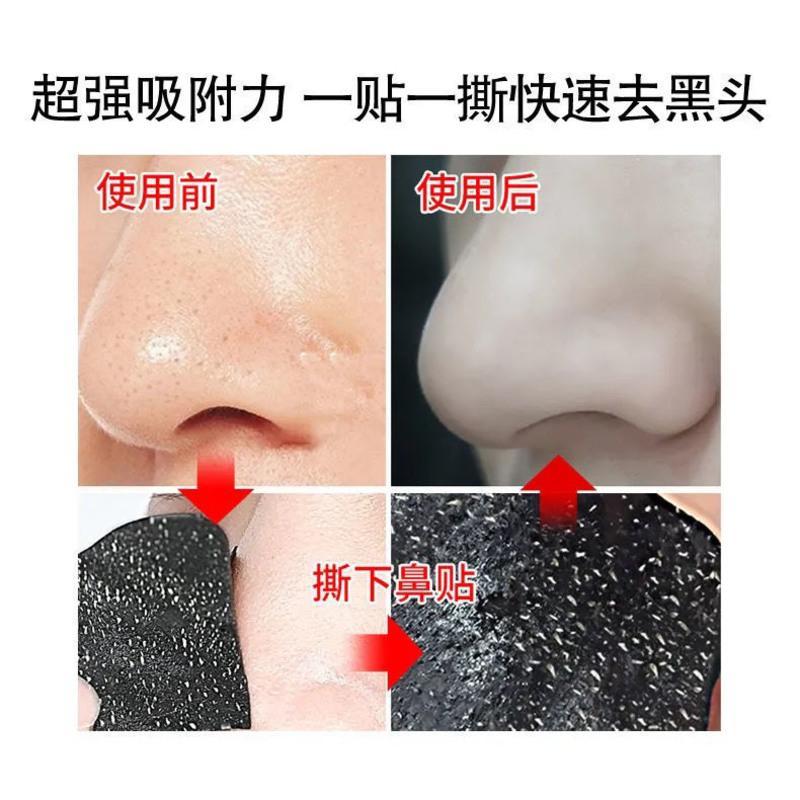 新人体验装[2片*3小贴] 韩纪猪鼻贴去黑头导出液三部曲t区去粉刺黑头贴鼻膜鼻贴收缩毛孔