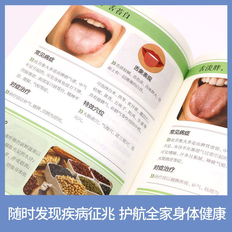 中国舌診大全 舌診論［改訂増補版］ 新・臨床中医学 舌診篇 | 陳 勇 |本 | 通販 | Amazon