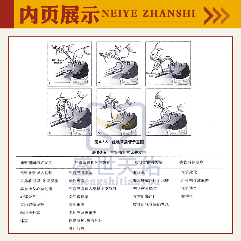 [正版]ICU主治医师手册+实用重症医学 第2版 2本 第2二版书籍ICU手册重症医学实用呼吸与危重症医学专科资质培训高清大图