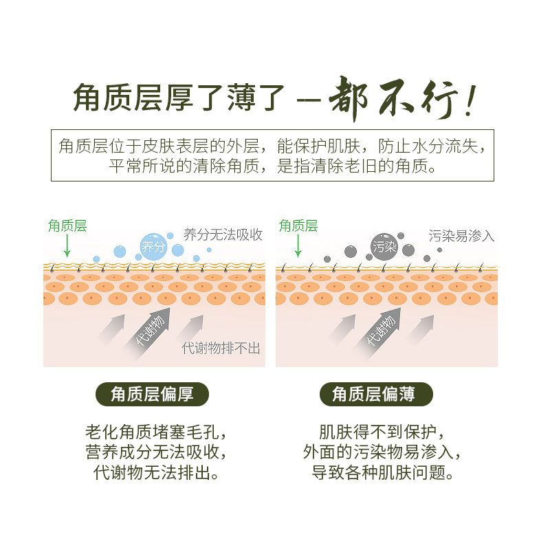 脸部去角质凝露120g 老中医脸部去角质啫喱去黑头粉刺面部女男士皮深层清洁缩毛孔