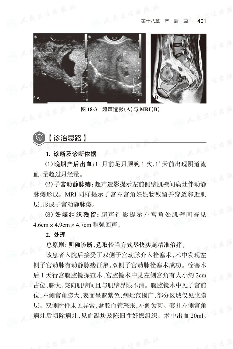 [正版] 产科危急重症病例解析 周容 孕早期至产褥期全周期 72例妊娠期并发症和28例妊娠期合并症妇产科 人民卫生高清大图