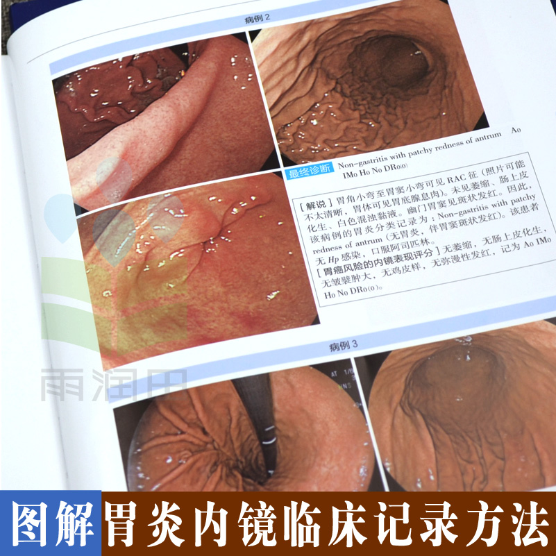 [正版]京都胃炎分类 内科手册 内科疾病诊疗指南 内科疾病鉴别诊断学 胃炎分类辅助诊断治疗 胃炎内镜诊断治疗技术 胃镜诊高清大图